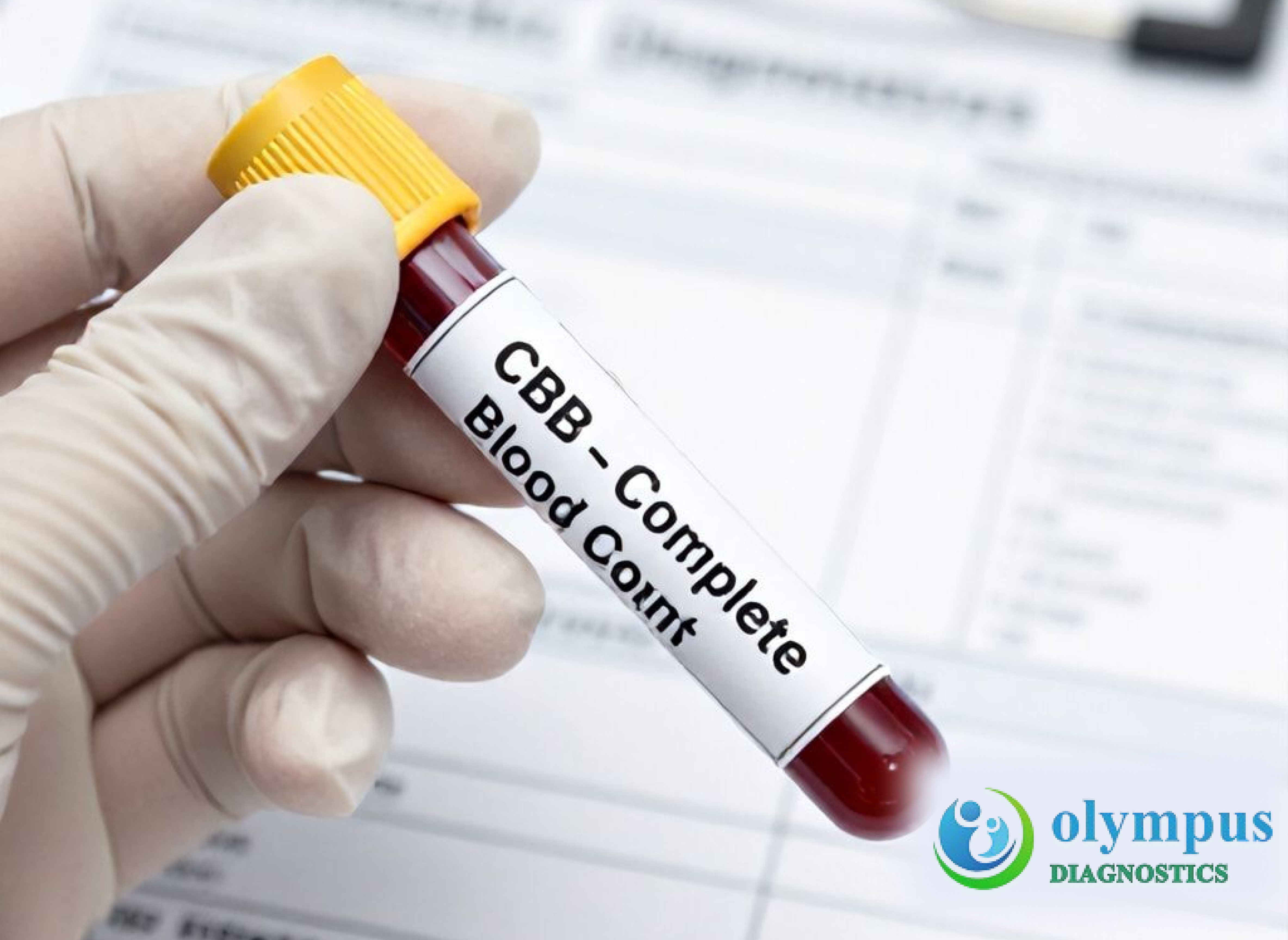 COMPLETE BLOOD COUNT(CBC)