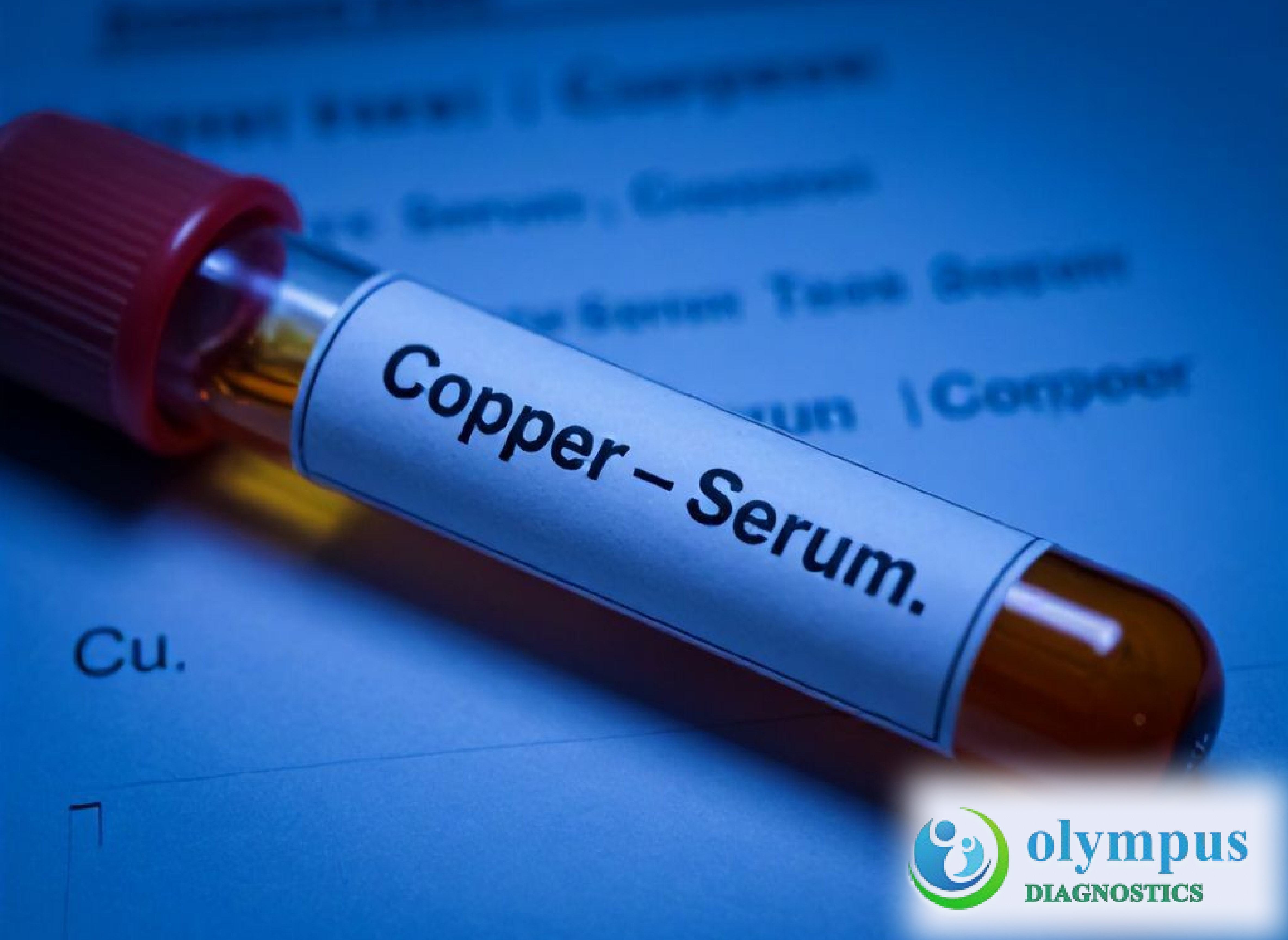 COPPER - SERUM