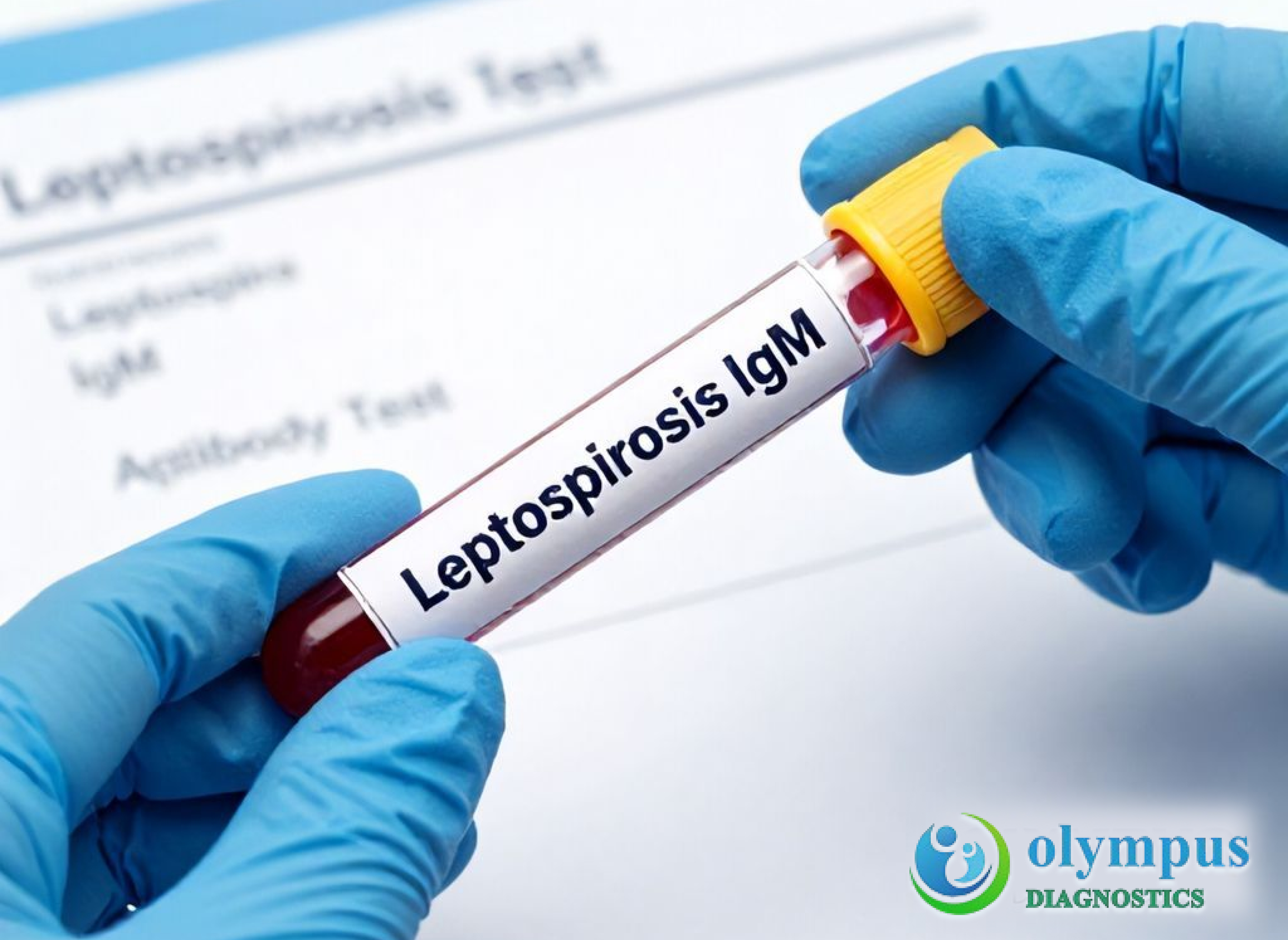 LEPTOSPIROSIS IgM