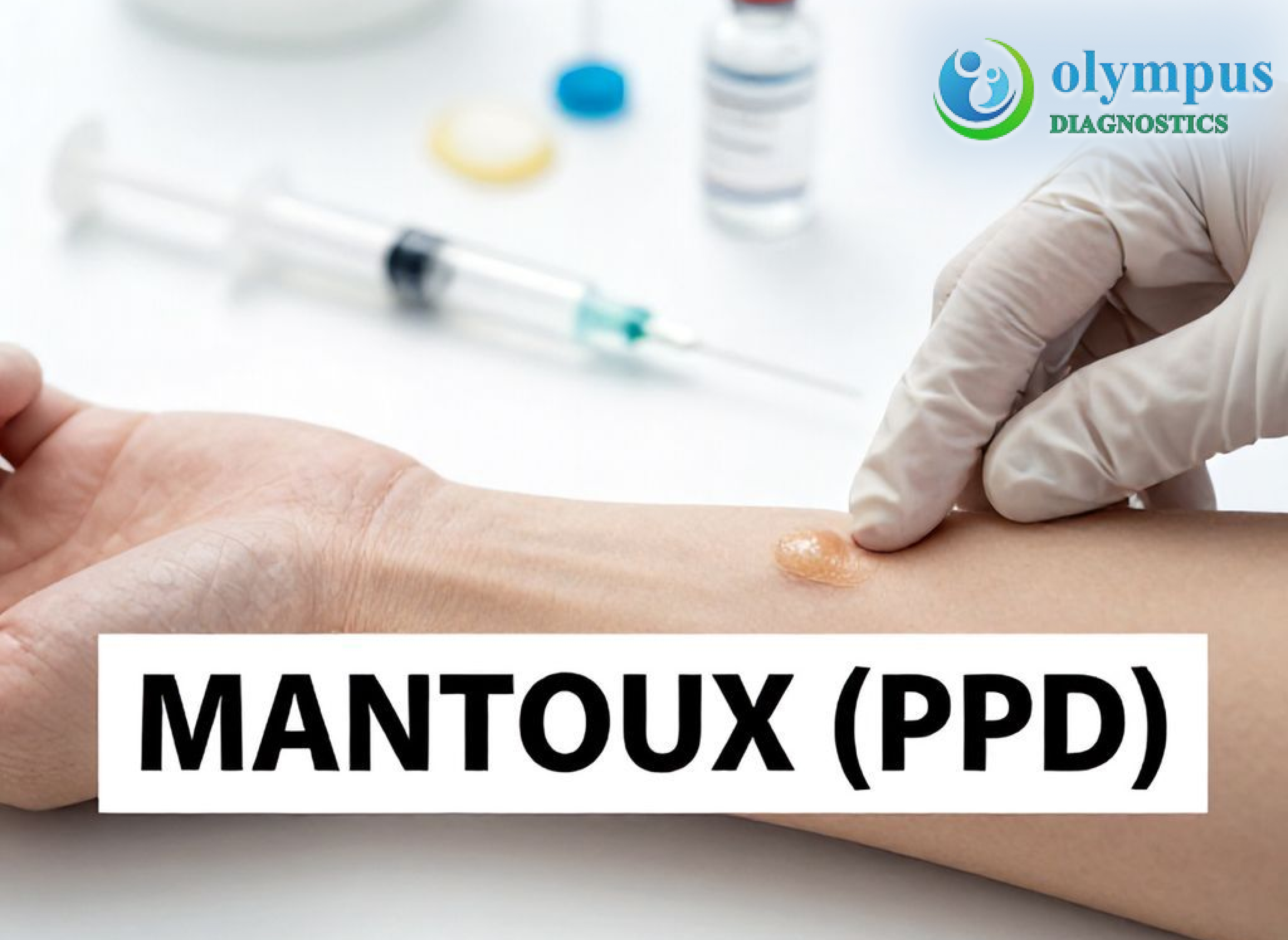 MANTOUX (PPD)