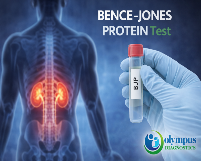 BENCE -JONES PROTEIN