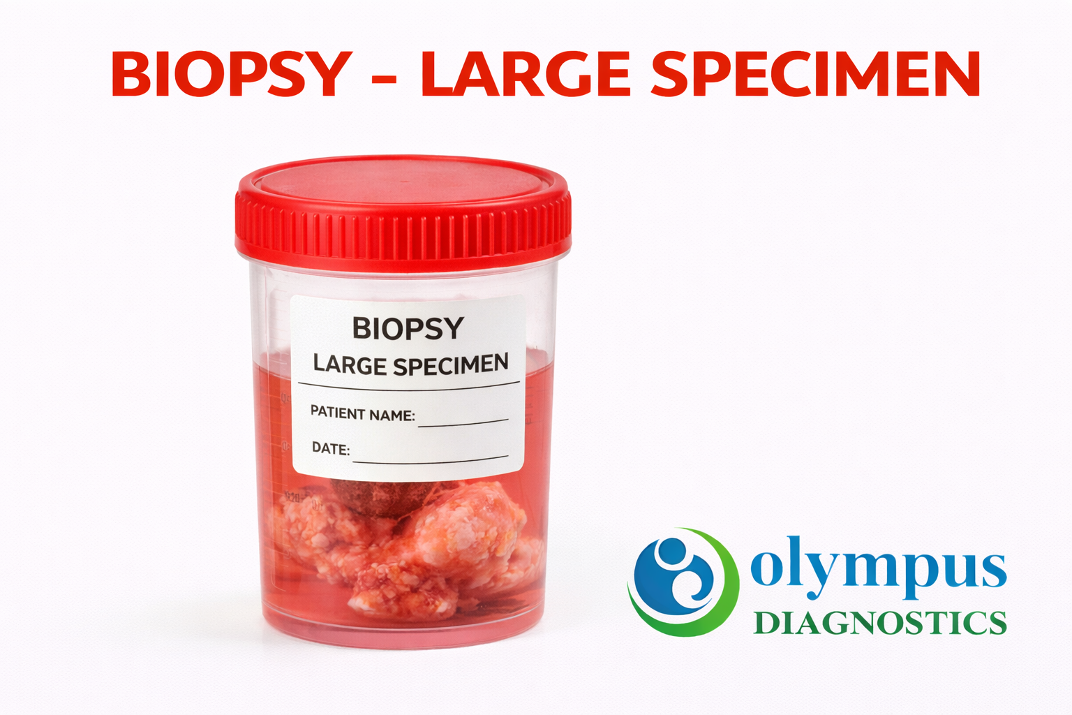 BIOPSY - LARGE SPECIMEN