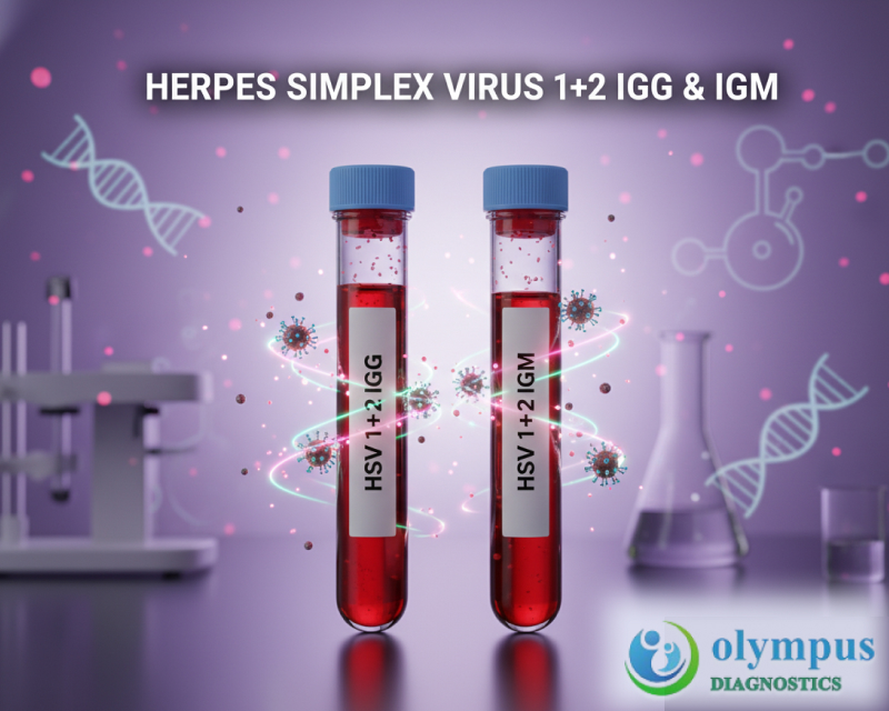 HERPES SIMPLEX VIRUS 1+2 IGG, SERUM, HERPES SIMPLEX VIRUS 1+2 IGM