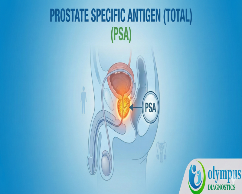 PROSTATE SPECIFIC ANTIGEN (TOTAL) - PSA 
