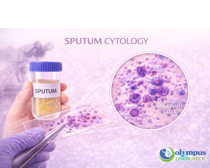 SPUTUM CYTOLOGY