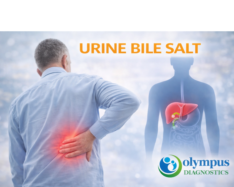 URINE BILE SALT